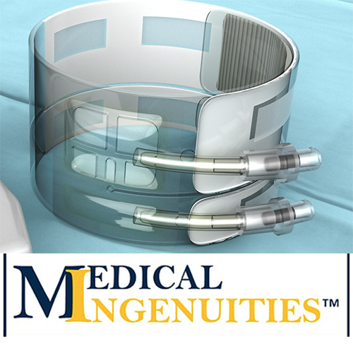 medical ingenuities genesis