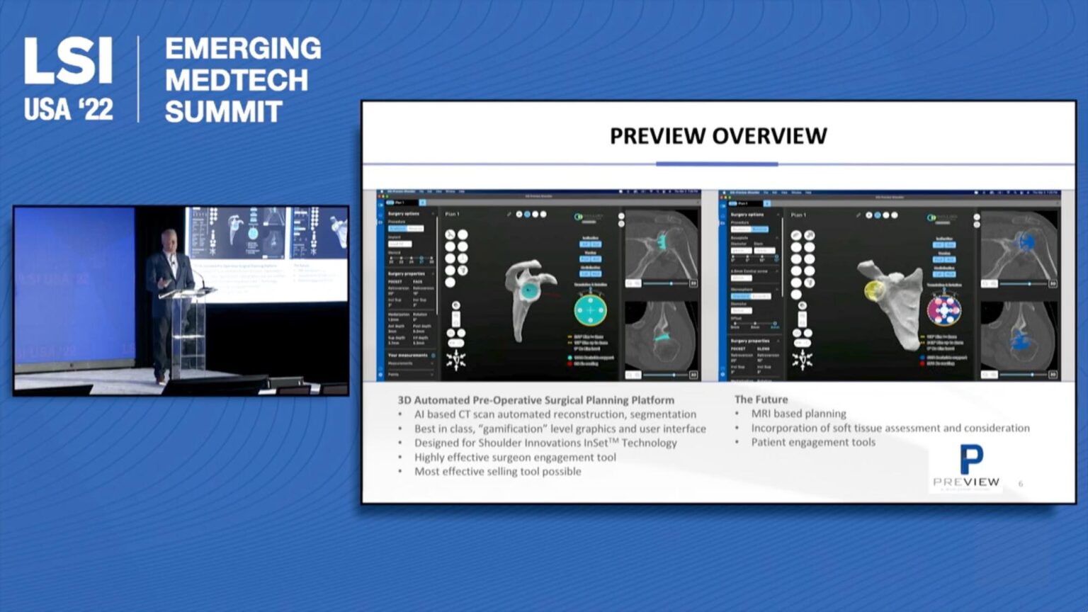 Shoulder Innovations Presentation at 2022 LSI Conference